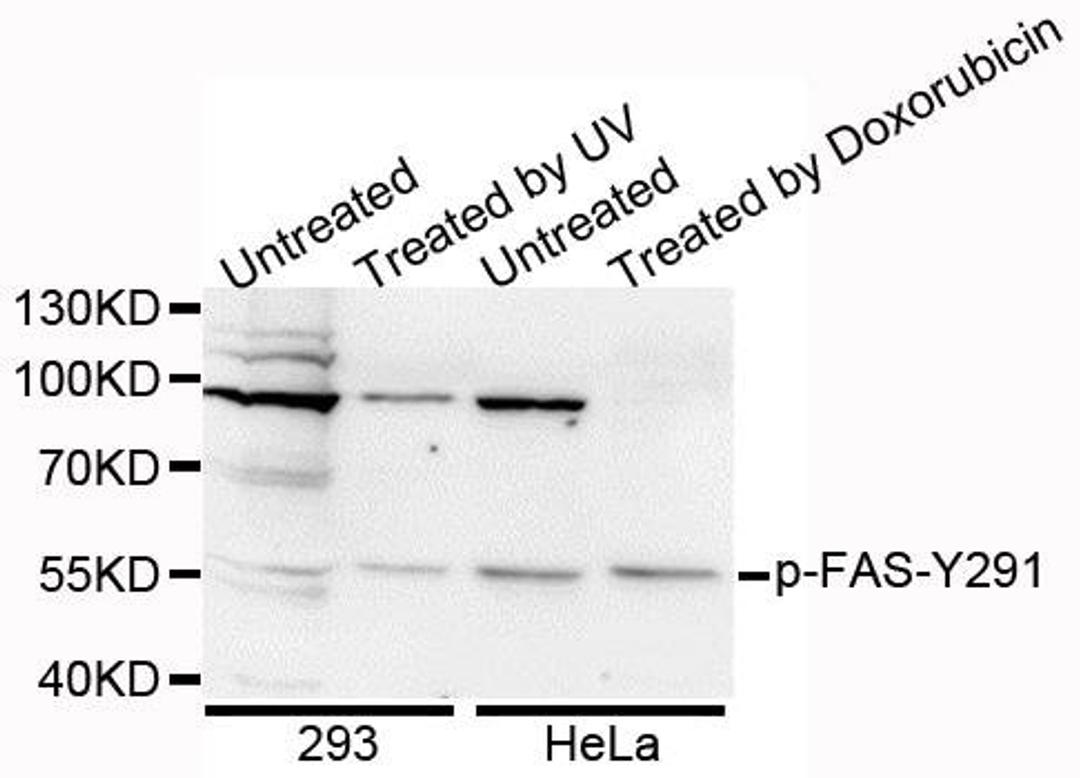 Western blot analysis of extracts of various cell lines using FAS (phospho-Tyr291) antibody