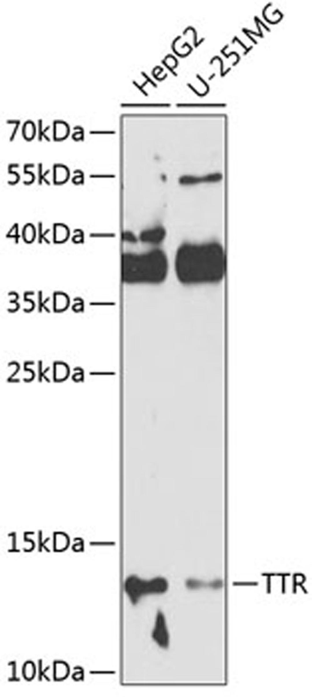 Western blot - TTR antibody (A1120)