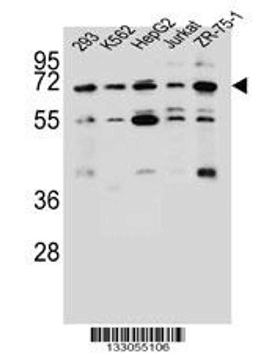 Western blot analysis in 293,K562,HepG2,Jurkat,ZR-75-1 cell line lysates (35ug/lane).