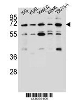 Western blot analysis in 293,K562,HepG2,Jurkat,ZR-75-1 cell line lysates (35ug/lane).