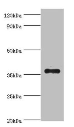 Western blot. All lanes: AKR1B10 antibody at 4µg/ml + A549 whole cell lysate. Secondary. Goat polyclonal to rabbit IgG at 1/10000 dilution. Predicted band size: 36 kDa. Observed band size: 36 kDa