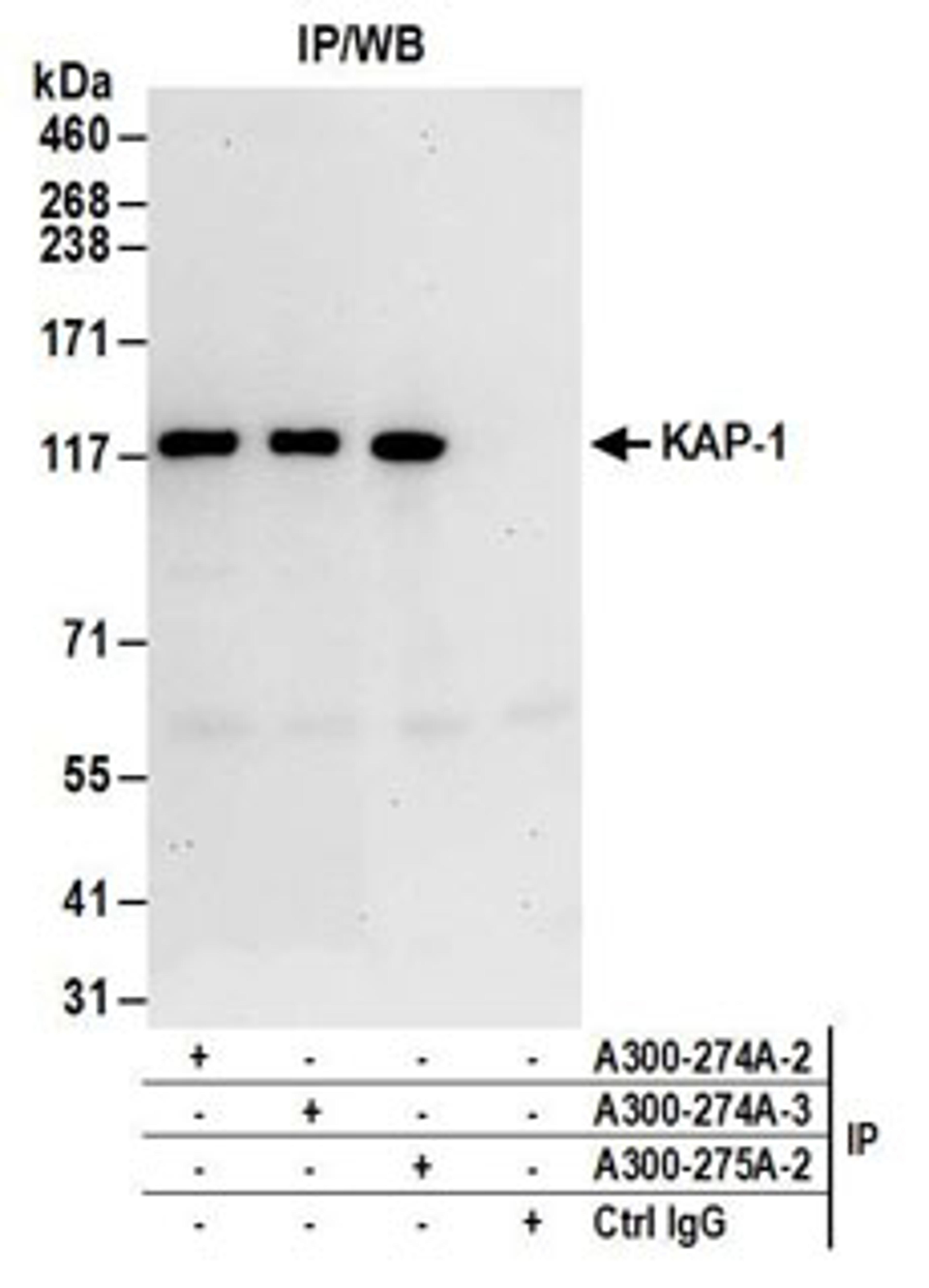 Detection of human KAP-1 by western blot of immunoprecipitates.