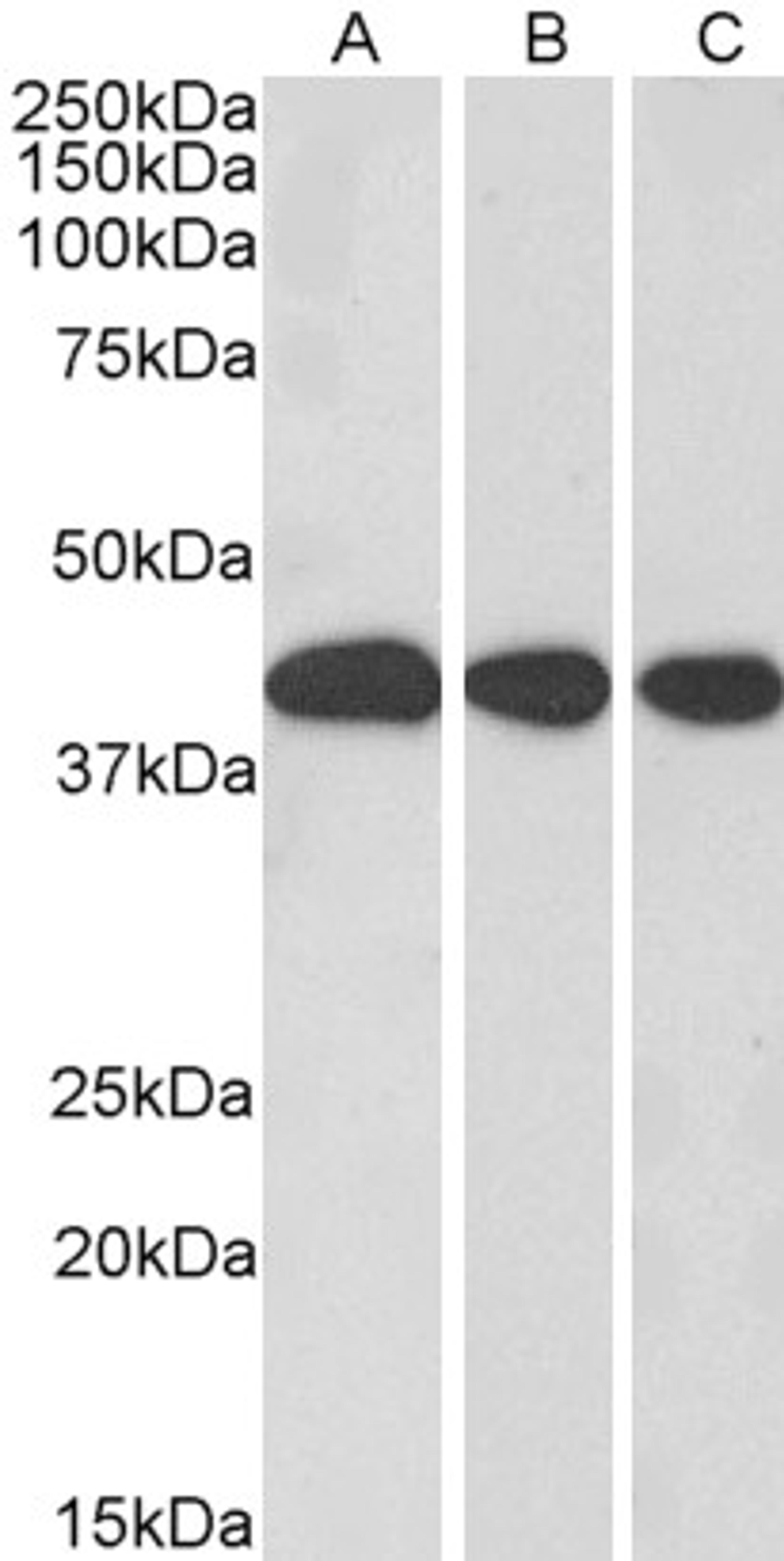 45-901 (0.3ug/ml) staining of Mouse Liver (A), Rat Liver (B) and Pig Liver (C) lysate (35ug protein in RIPA buffer). Primary incubation was 1 hour. Detected by chemiluminescence