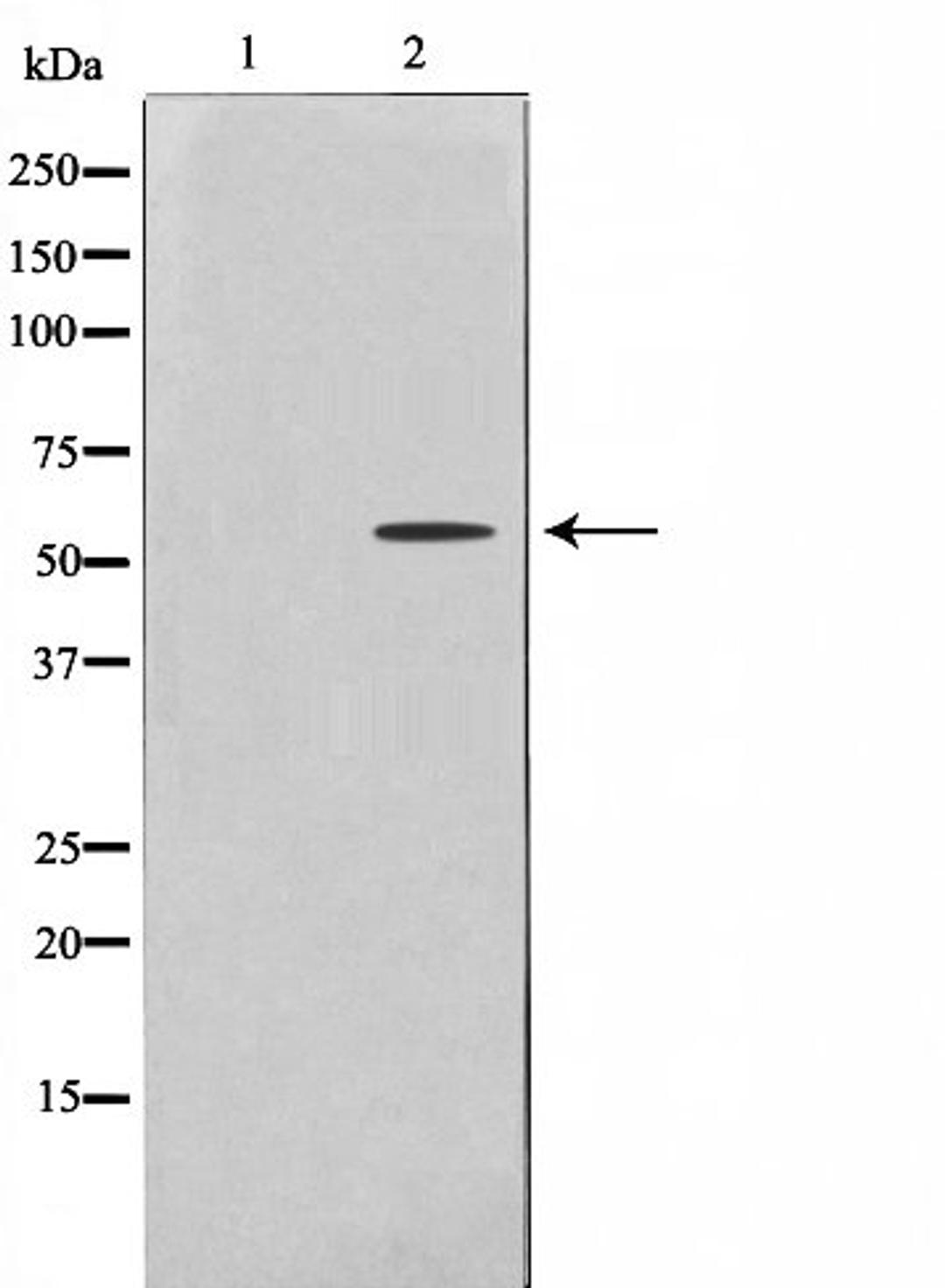 Western blot analysis of HeLa cell lysate using 2U1 (Cytochrome P450) antibody