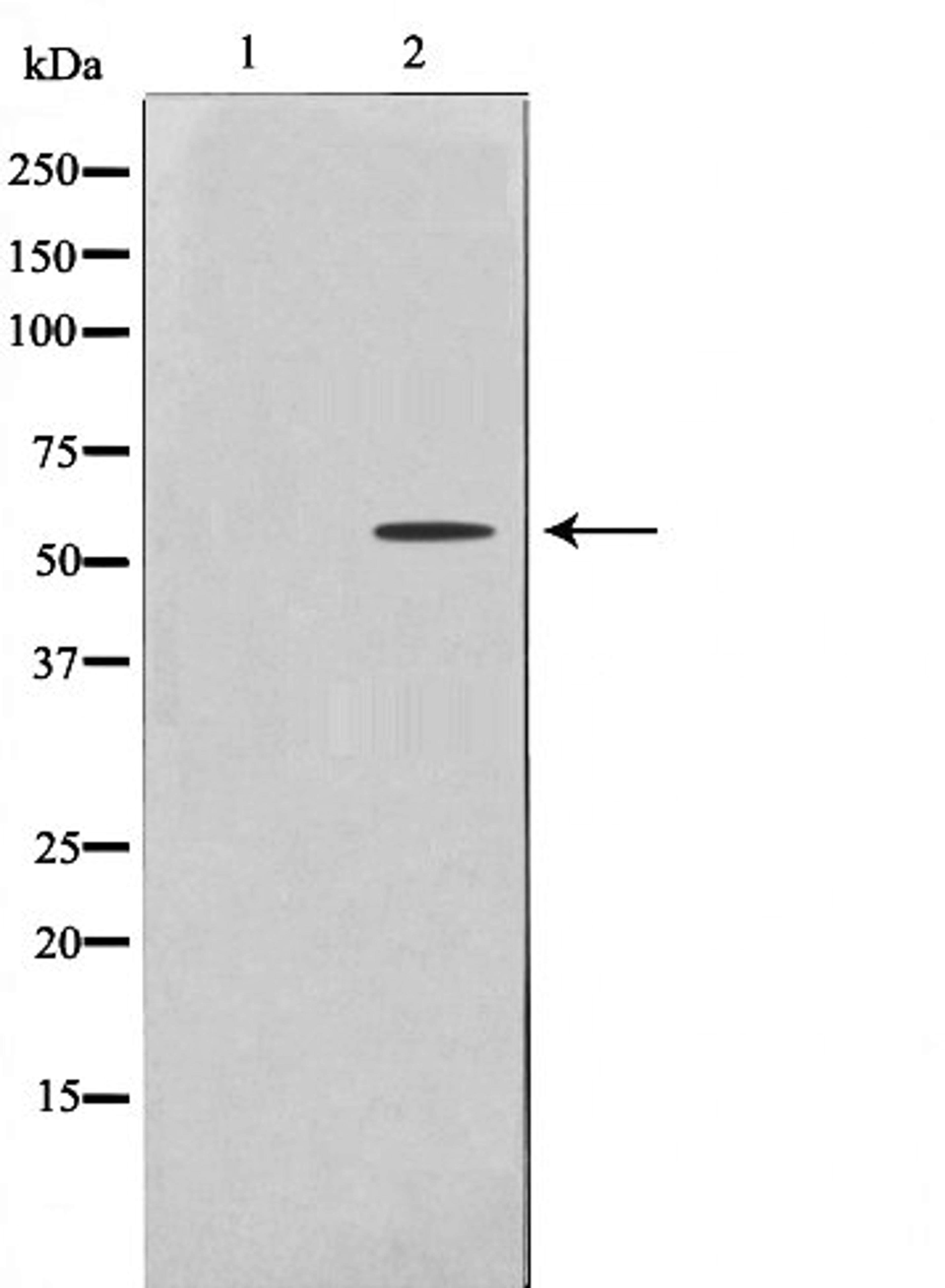 Western blot analysis of HeLa cell lysate using 2U1 (Cytochrome P450) antibody