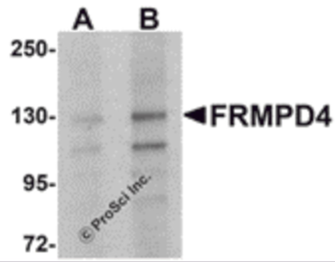 Western blot analysis of FRMPD4 in SK-N-SH cell lysate with FRMPD4 antibody at (A) 1 and (B) 2 μg/mL.