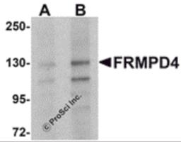 Western blot analysis of FRMPD4 in SK-N-SH cell lysate with FRMPD4 antibody at (A) 1 and (B) 2 μg/mL.
