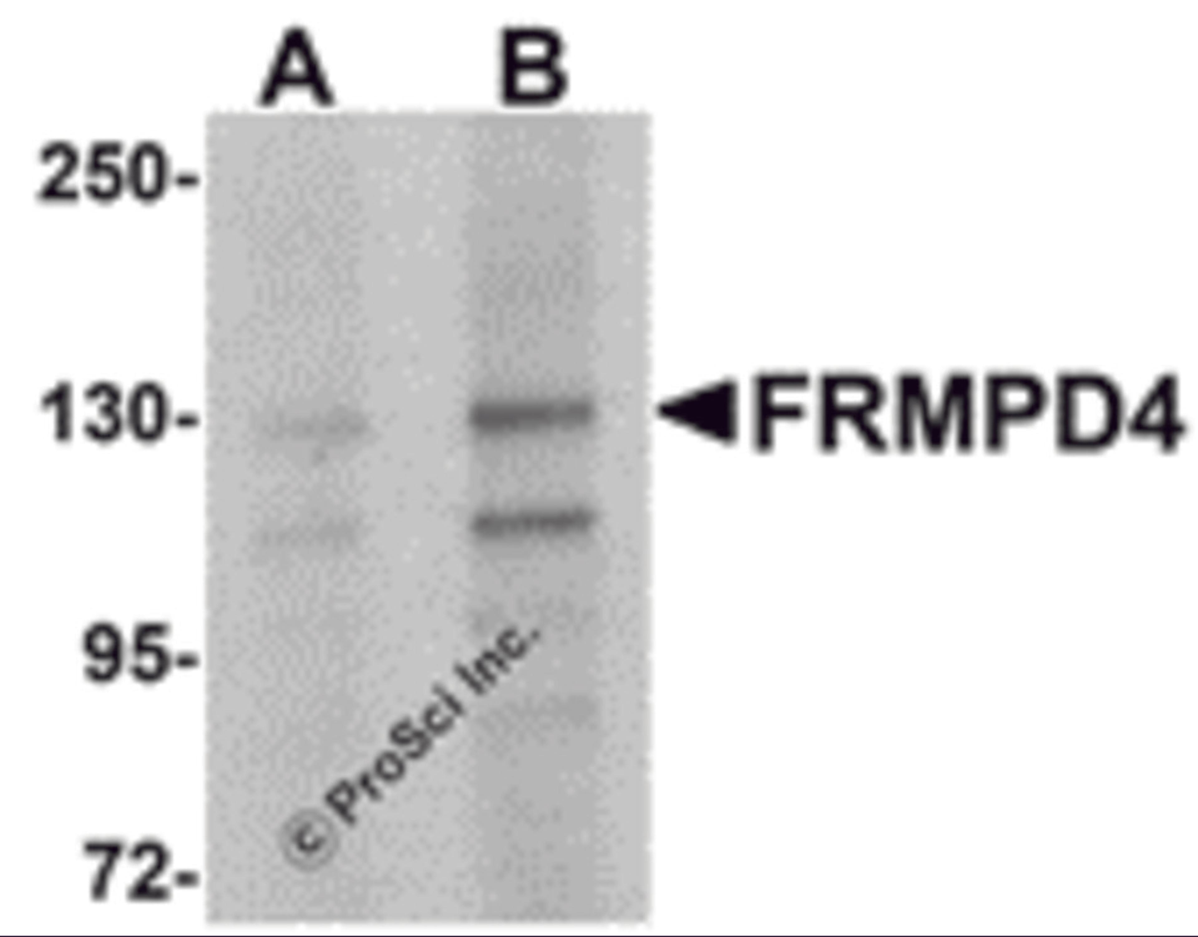 Western blot analysis of FRMPD4 in SK-N-SH cell lysate with FRMPD4 antibody at (A) 1 and (B) 2 μg/mL.