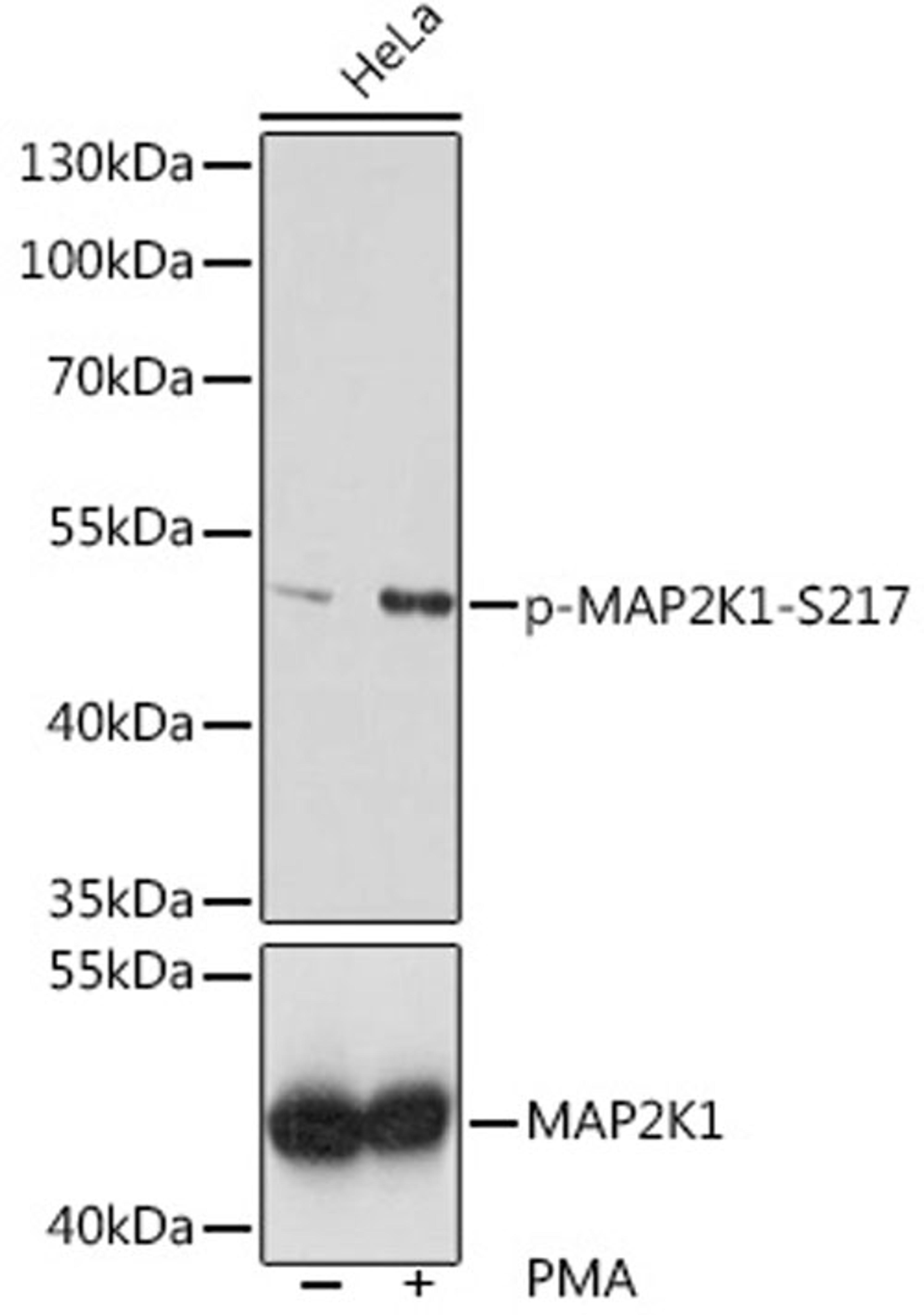 Western blot - Phospho-MAP2K1-S217 pAb (AP0062)