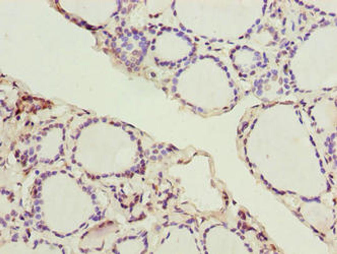 Immunohistochemistry of paraffin-embedded human thyroid tissue using CSB-PA878904LA01HU at dilution of 1:100
