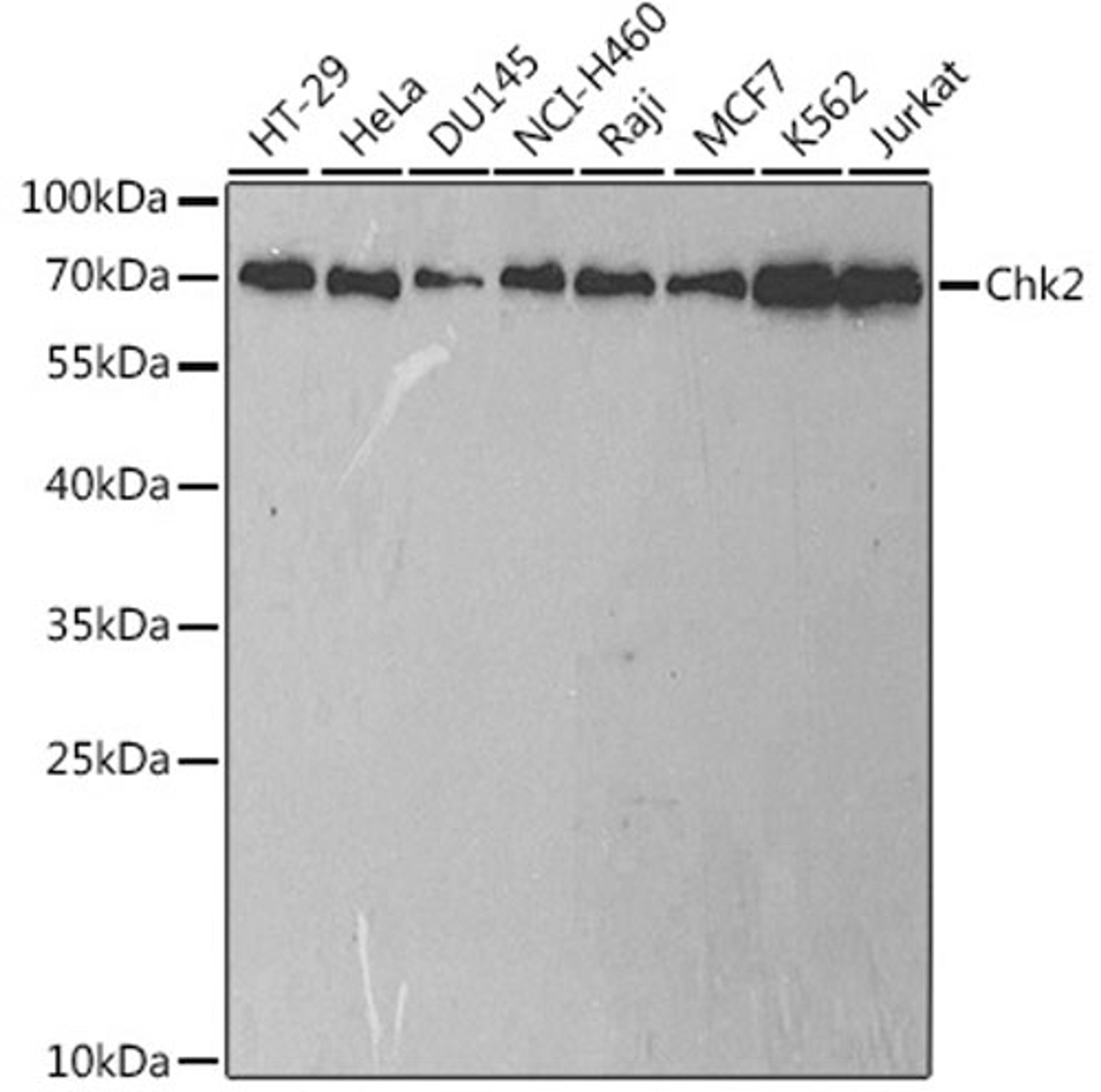 Western blot - Chk2 antibody (A2145)