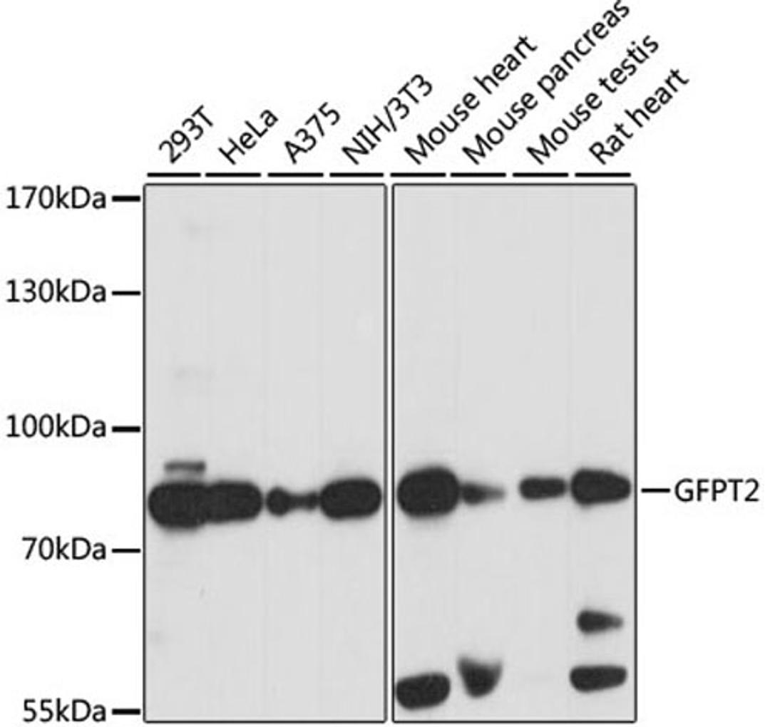 Western blot - GFPT2 antibody (A15374)