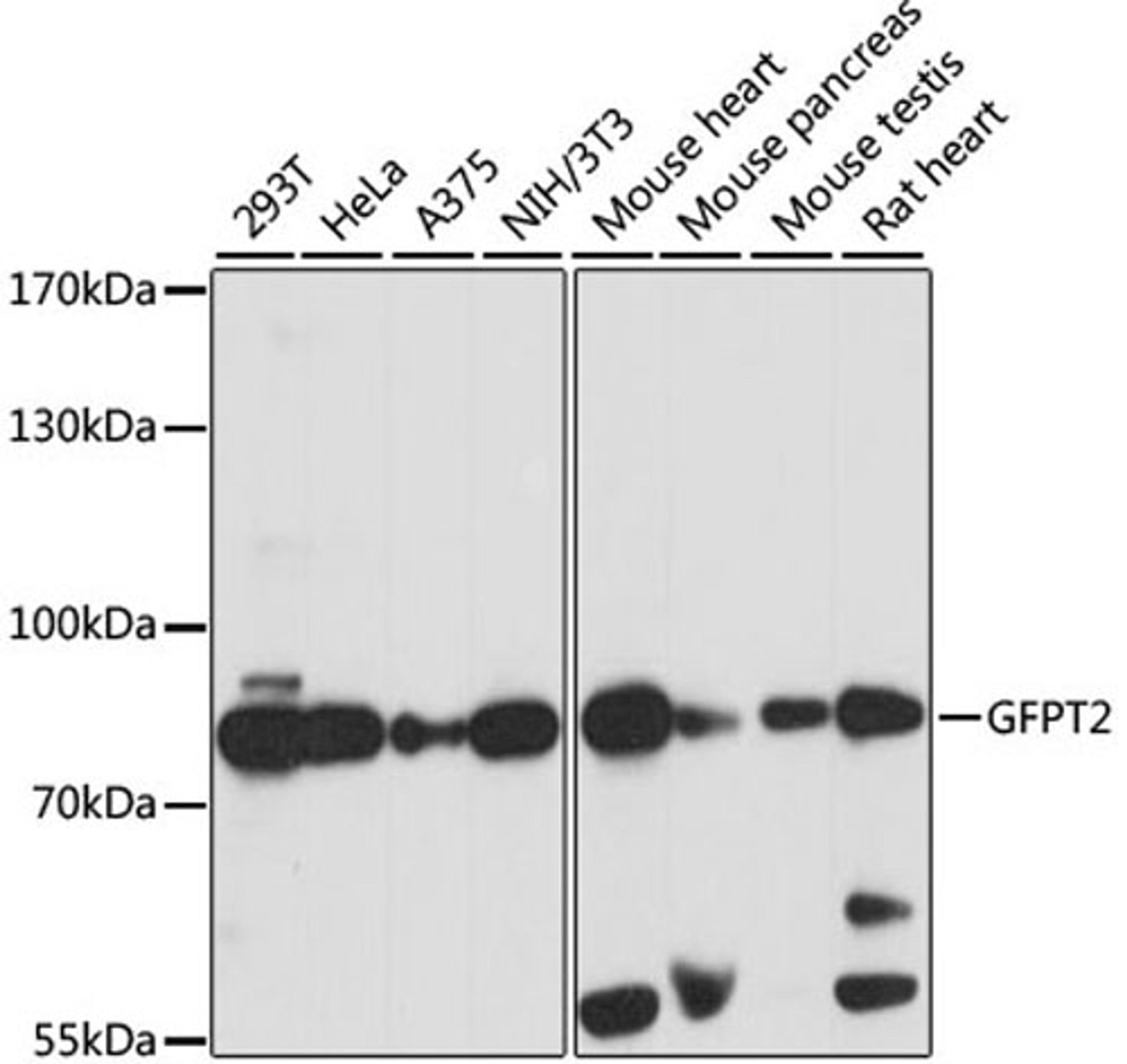 Western blot - GFPT2 antibody (A15374)