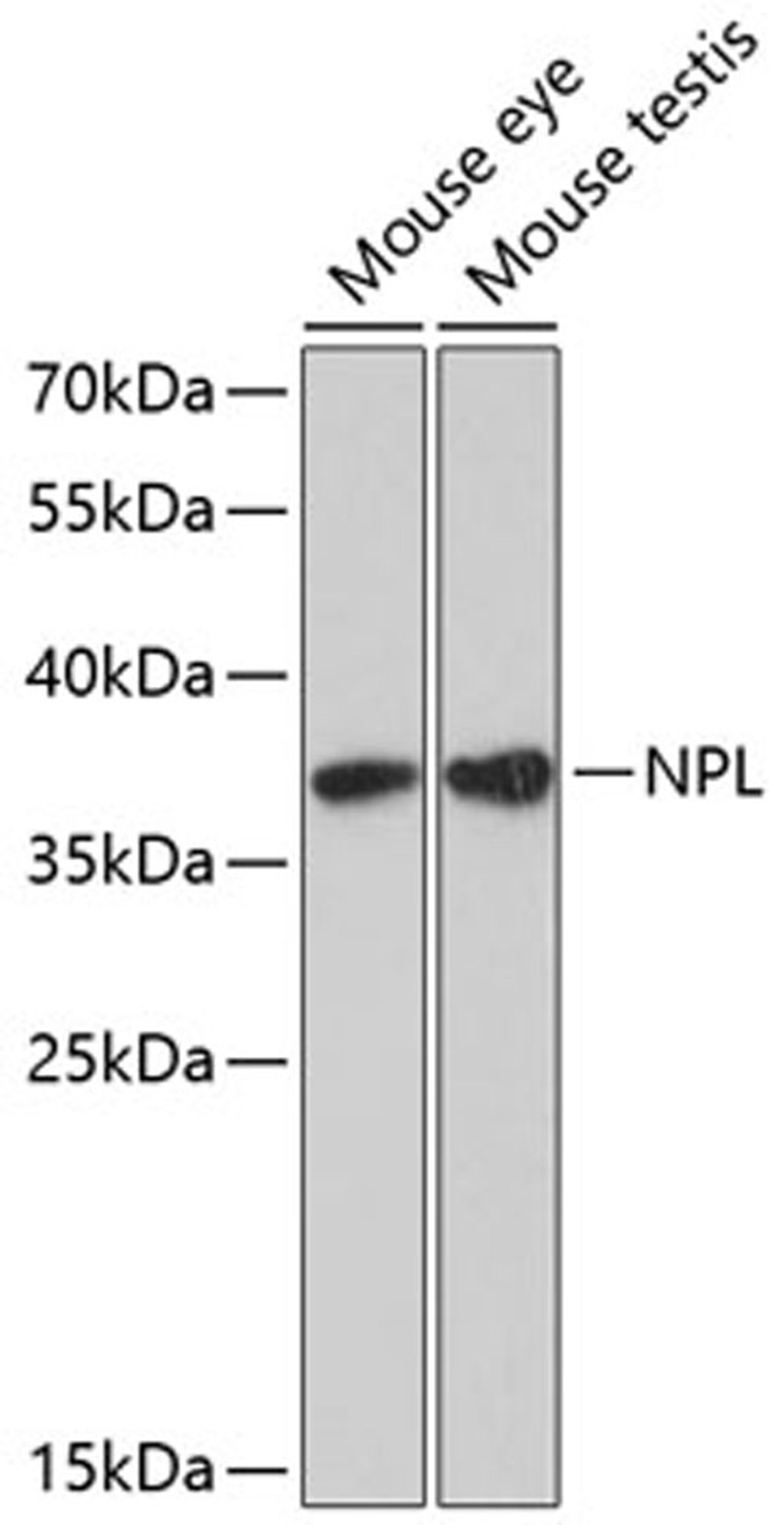 Western blot - NPL antibody (A9210)