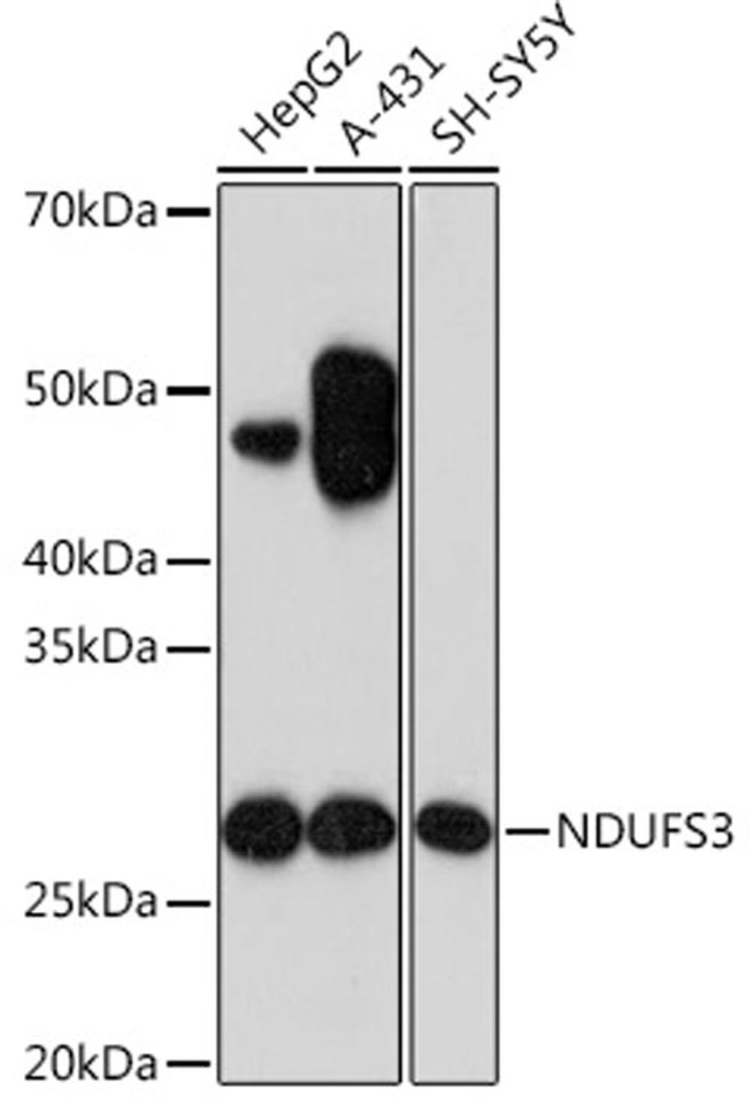 Western blot - NDUFS3 Rabbit mAb (A4602)