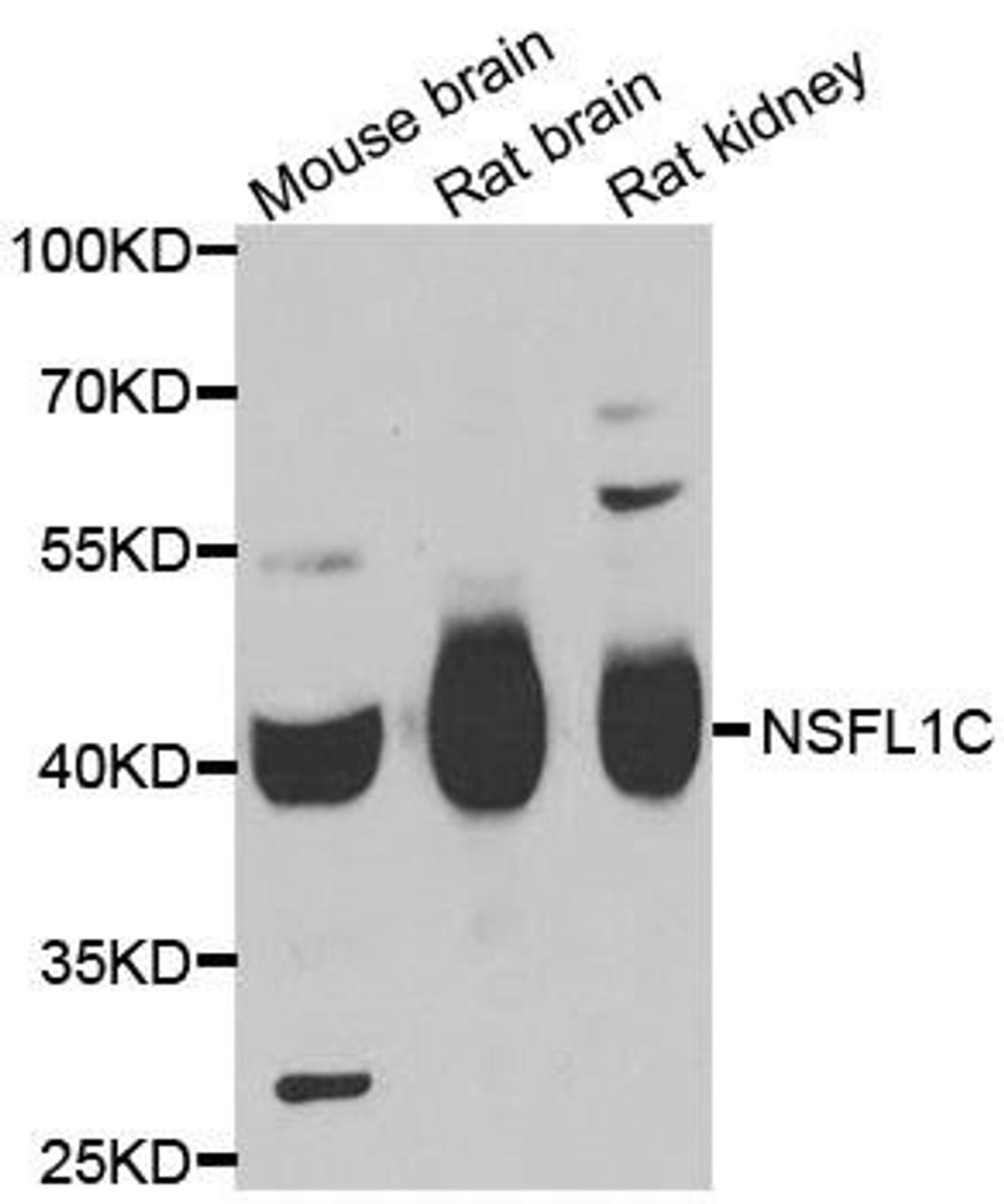 Western blot analysis of extracts of various cell lines using NSFL1C antibody