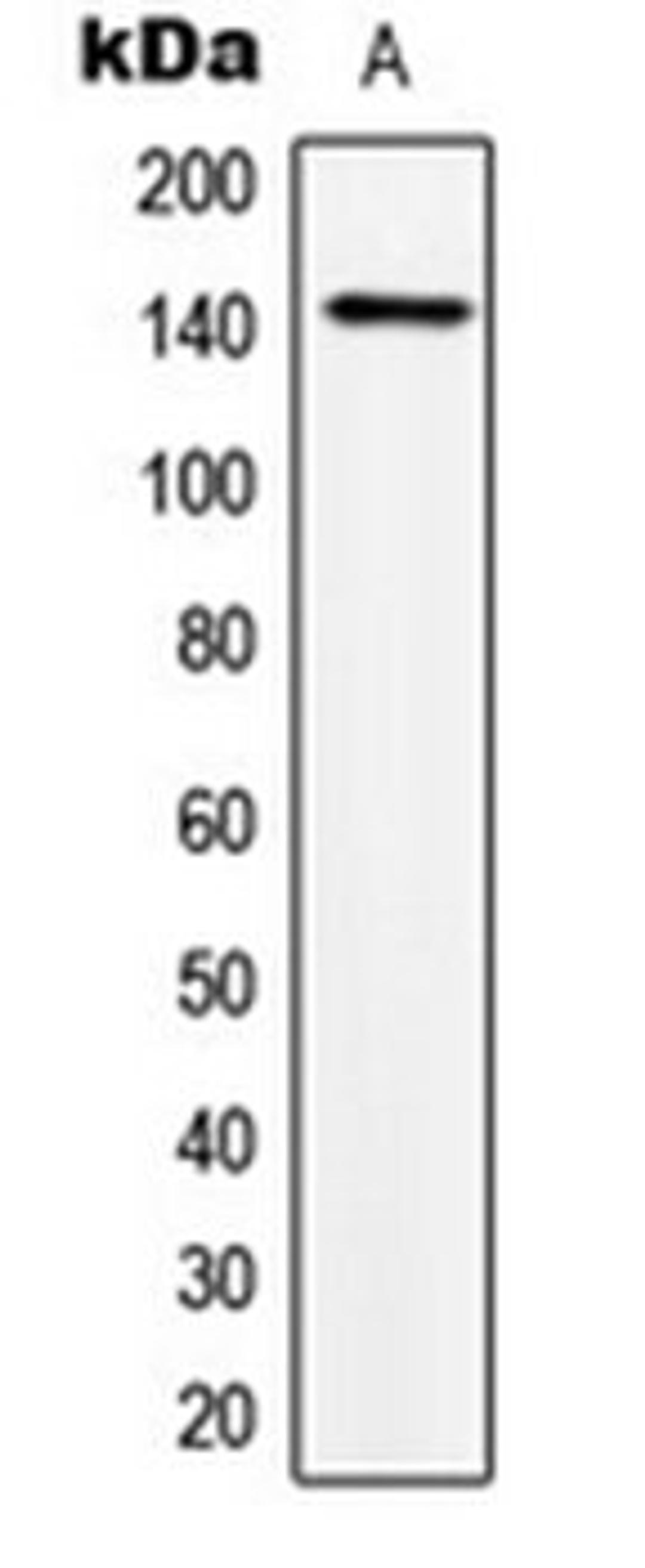 Western blot analysis of HeLa (Lane 1) whole cell lysates using TRPS1 antibody