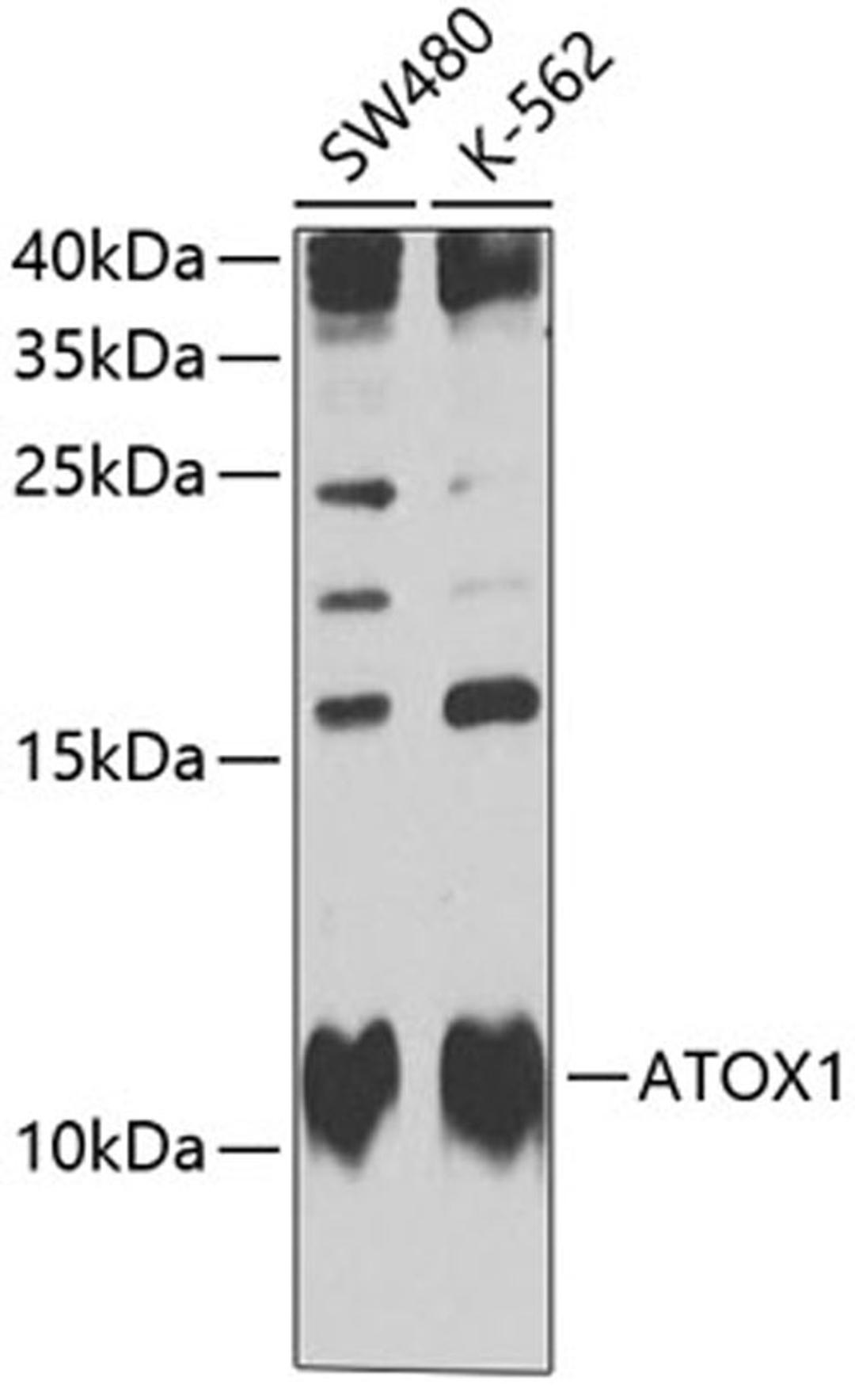 Western blot - ATOX1 Antibody (A6874)