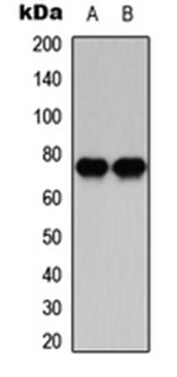 Western blot analysis of HeLa (Lane 1), Raw264.7 (Lane 2) whole cell lysates using PKC beta antibody