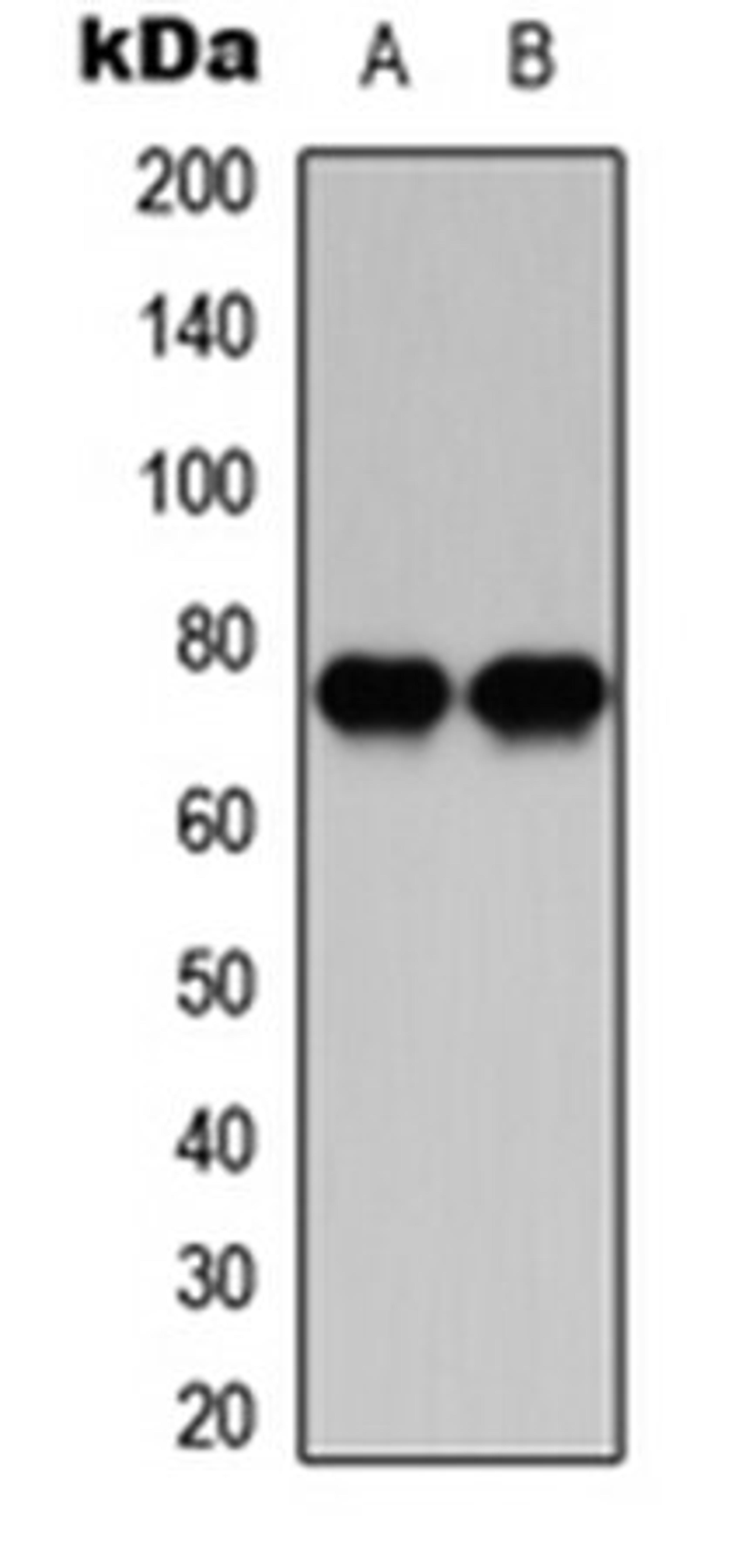 Western blot analysis of HeLa (Lane 1), Raw264.7 (Lane 2) whole cell lysates using PKC beta antibody