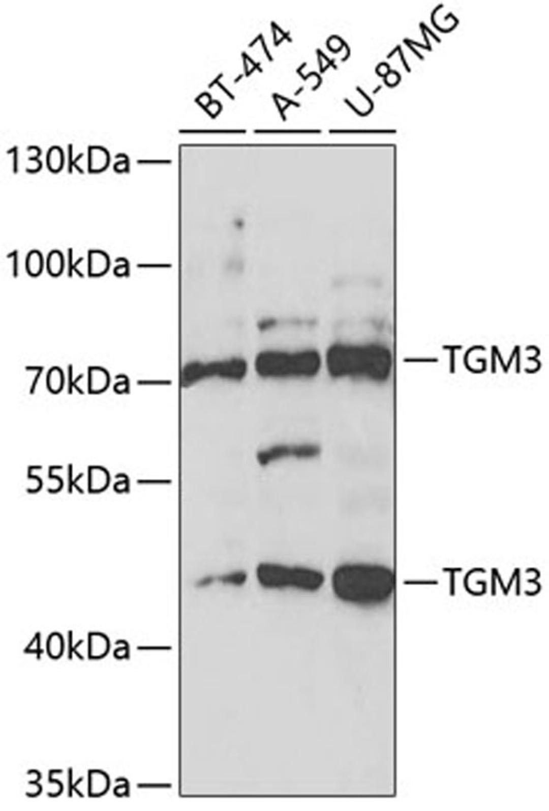 Western blot - TGM3 antibody (A5856)