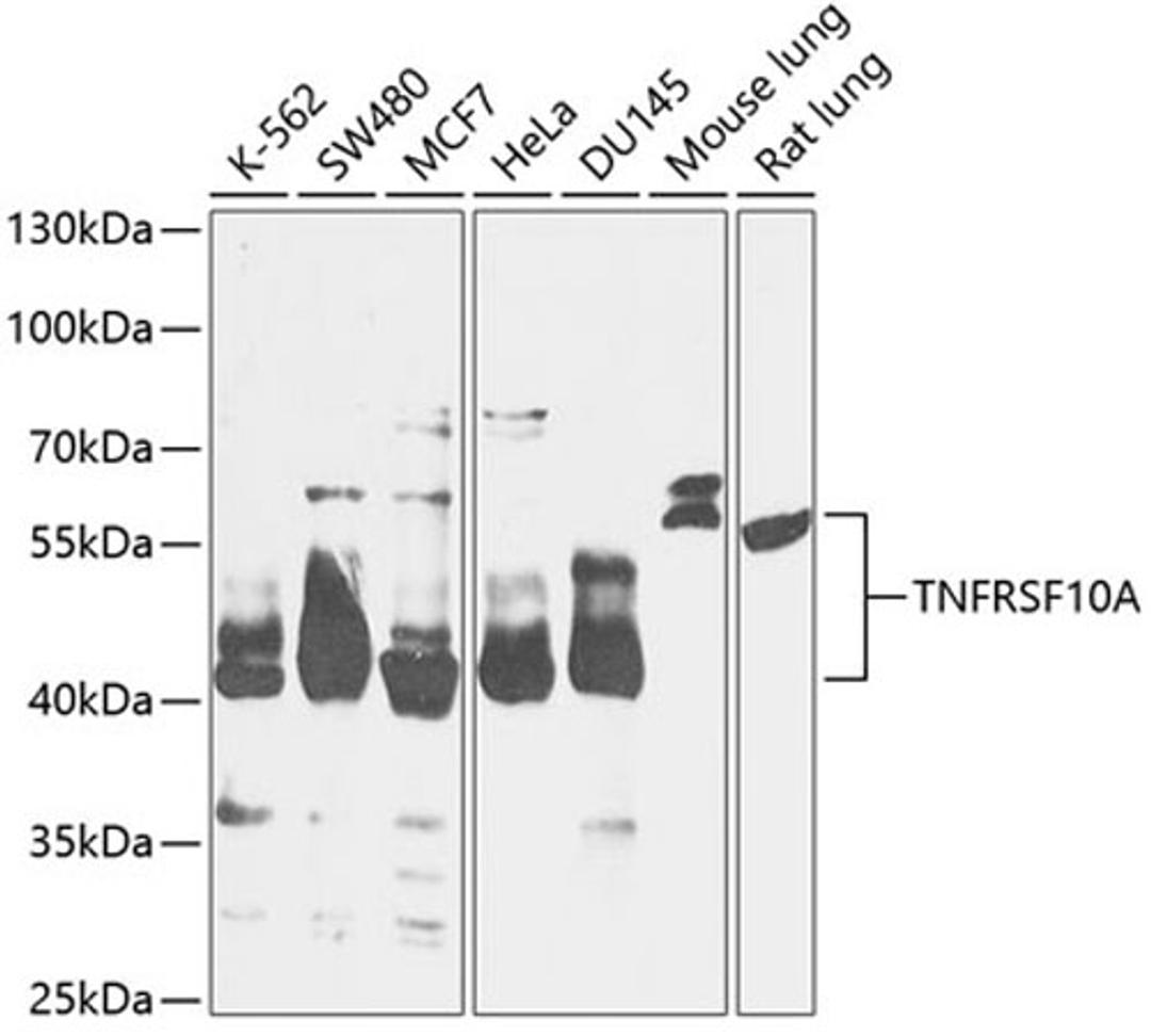 Western blot - TNFRSF10A antibody (A12540)