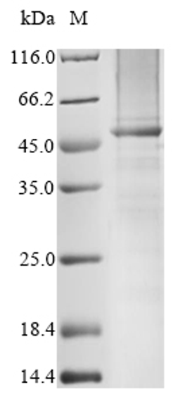 (Tris-Glycine gel) Discontinuous SDS-PAGE (reduced) with 5% enrichment gel and 15% separation gel.
