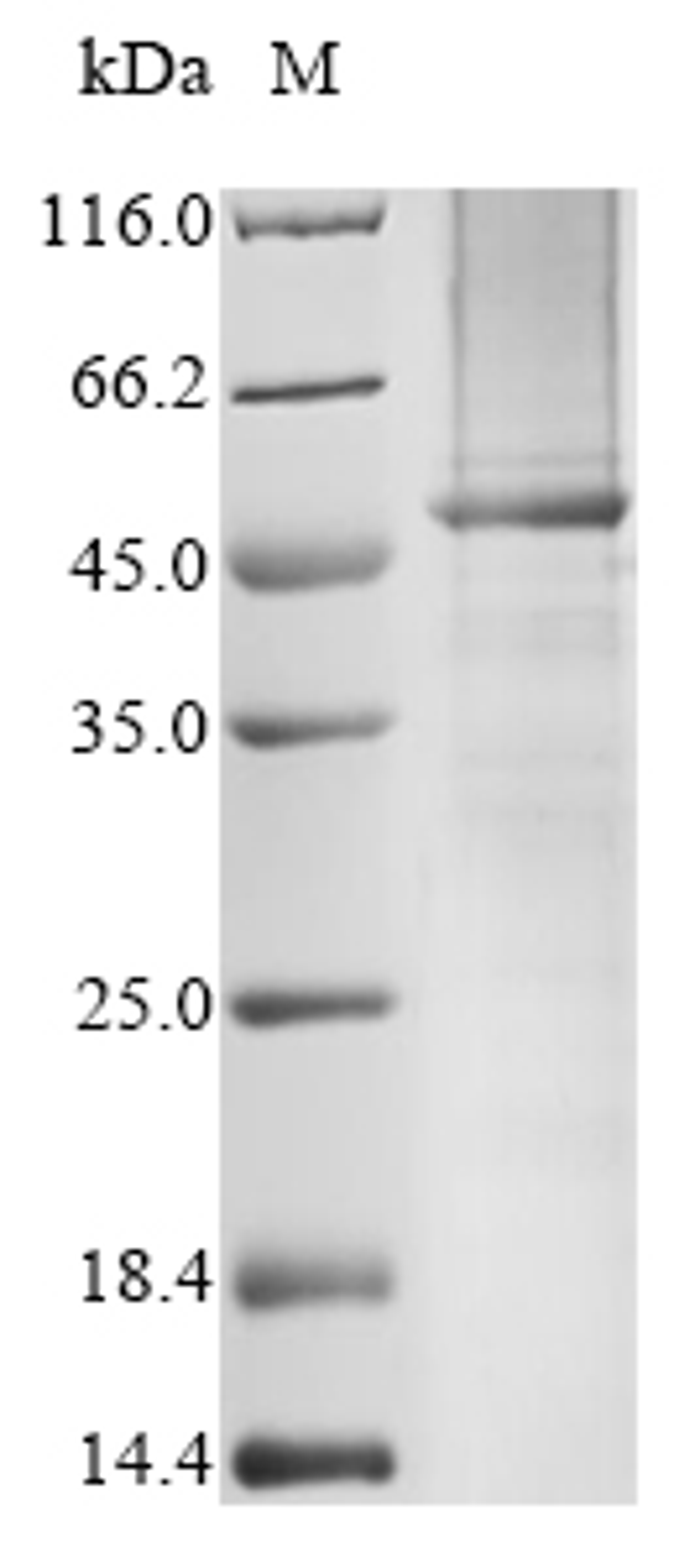 (Tris-Glycine gel) Discontinuous SDS-PAGE (reduced) with 5% enrichment gel and 15% separation gel.