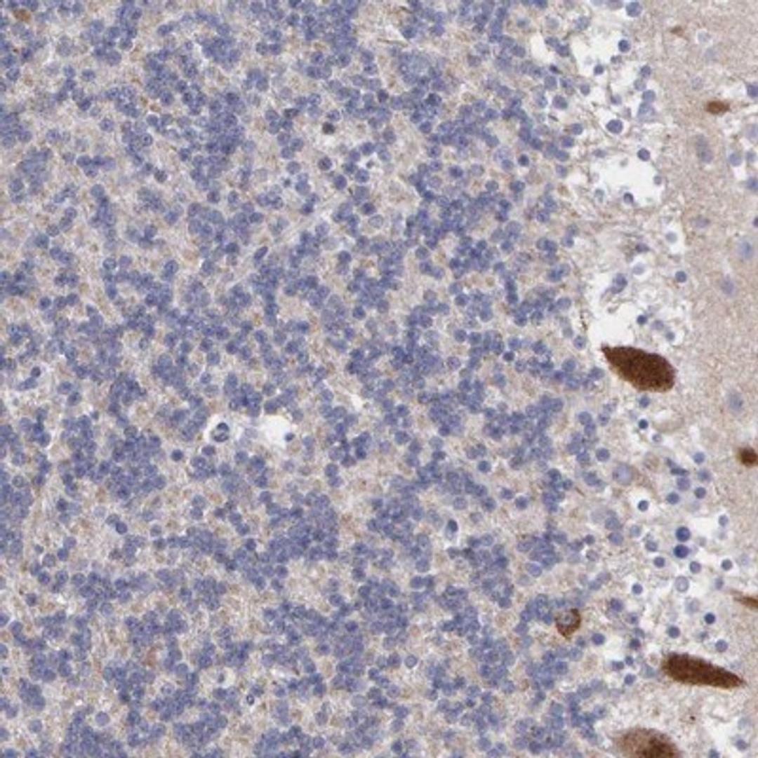 Immunohistochemistry-Paraffin: NPTXR Antibody [NBP1-86531] - Staining of human cerebellum shows strong cytoplasmic positivity in purkinje cells.