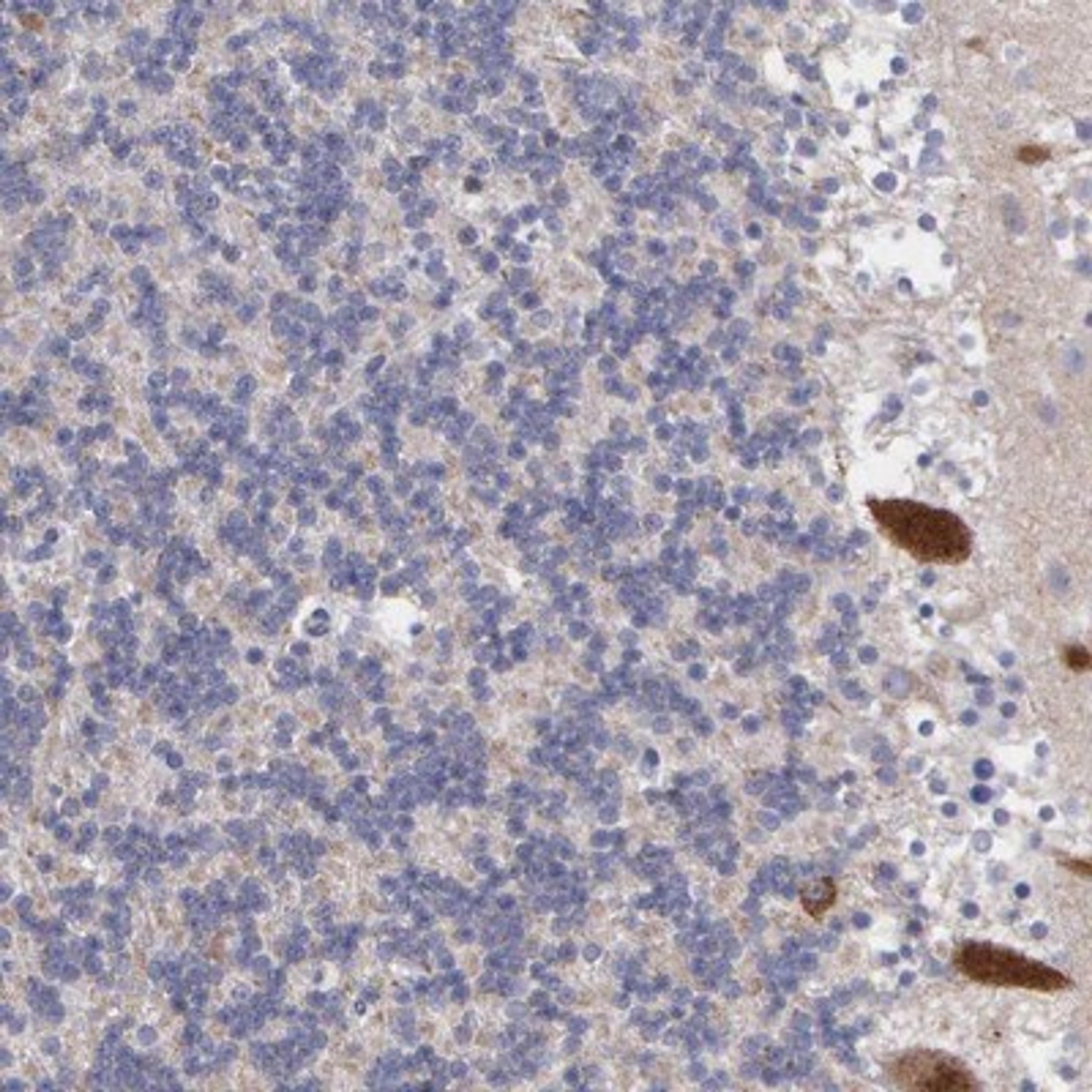 Immunohistochemistry-Paraffin: NPTXR Antibody [NBP1-86531] - Staining of human cerebellum shows strong cytoplasmic positivity in purkinje cells.