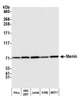 Detection of human Menin by western blot.