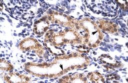 Antibody used in IHC on Human kidney.