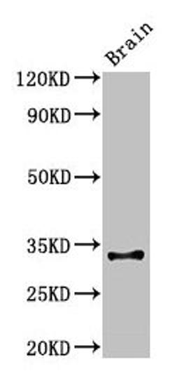 Western Blot. Positive WB detected in: Mouse brain tissue. All lanes: Cd74 antibody at 3µg/ml. Secondary. Goat polyclonal to rabbit IgG at 1/50000 dilution. Predicted band size: 32, 25 kDa. Observed band size: 32 kDa