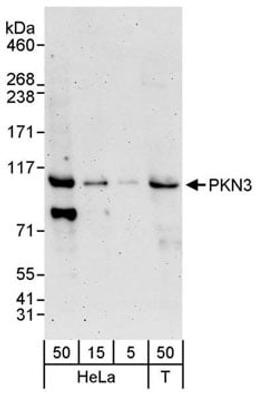 Detection of human PKN3 by western blot.