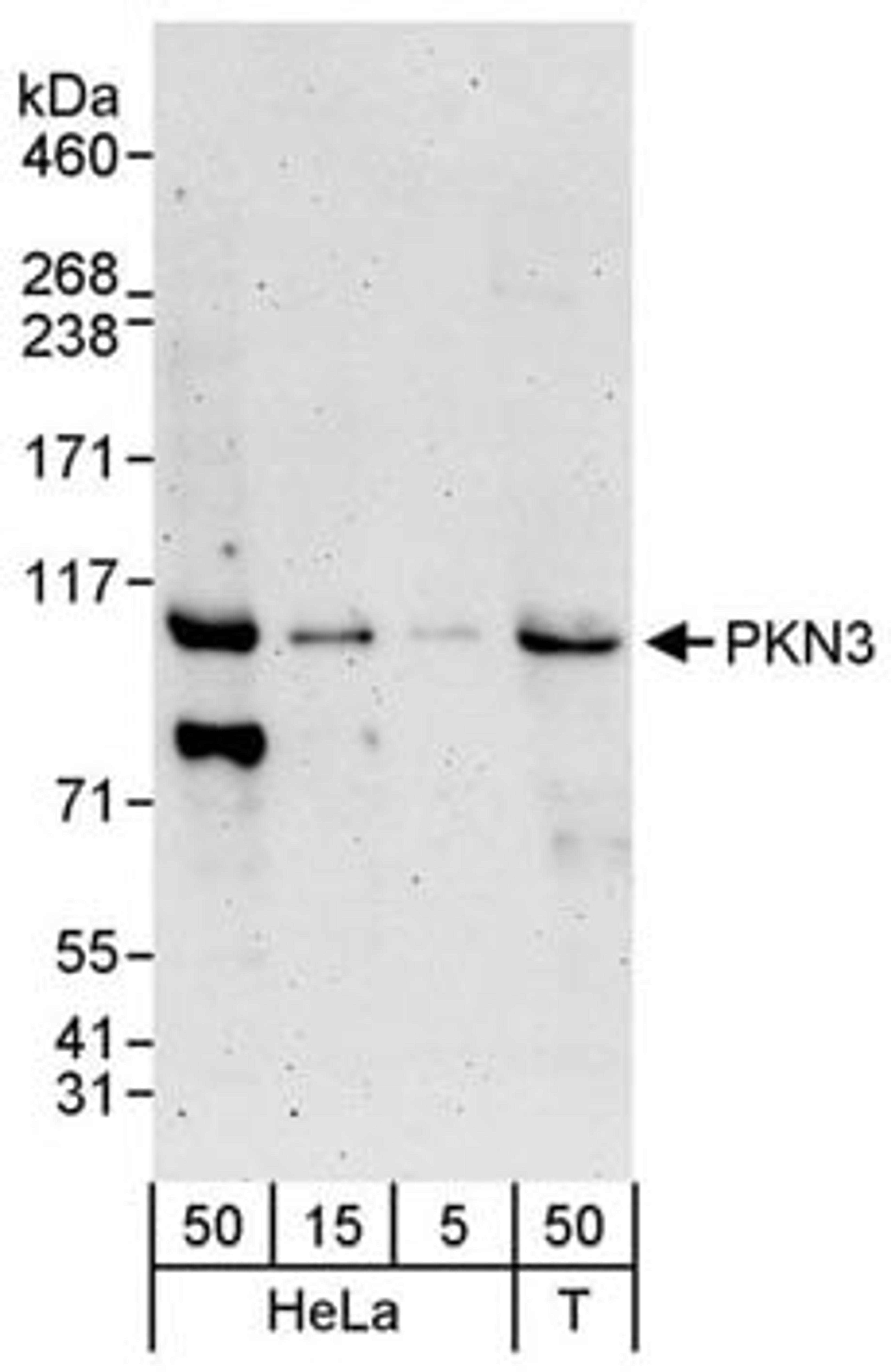 Detection of human PKN3 by western blot.