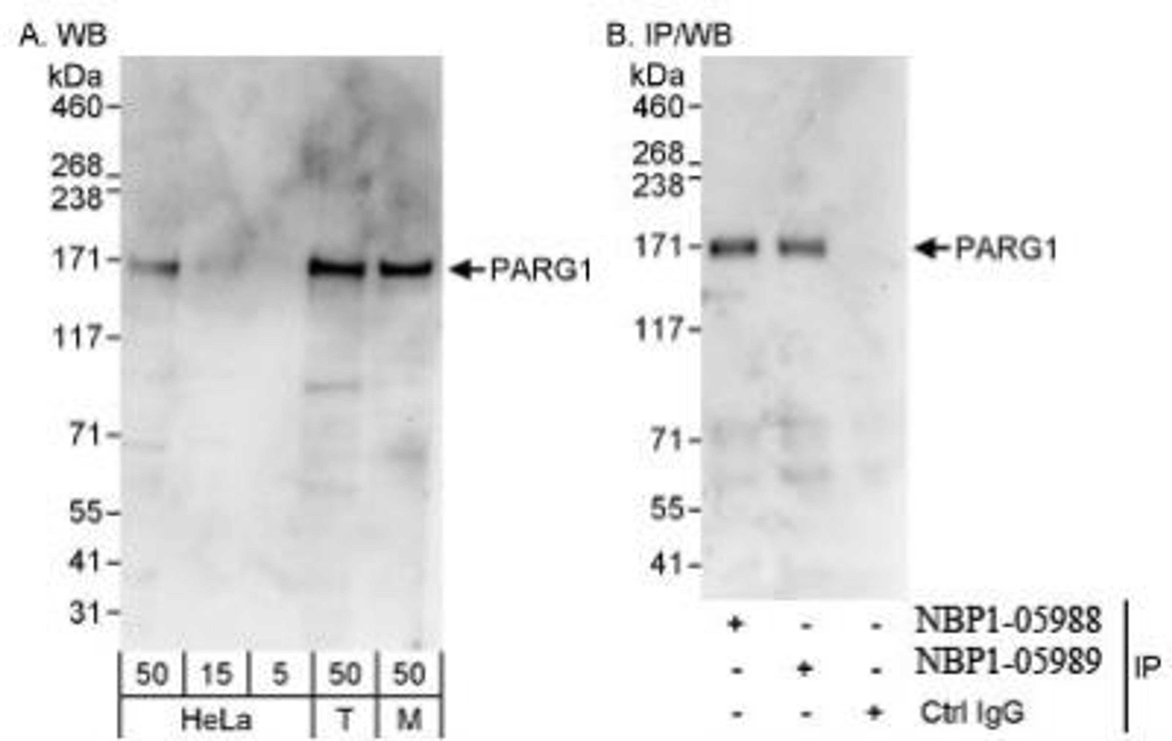 Western Blot: PARG1 Antibody [NBP1-05989] - Whole cell  lysate from HeLa, 293T, and mouse NIH3T3 cells. PARG1 was also  immunoprecipitated by rabbit anti-PARG1 antibody NBP1-05988.