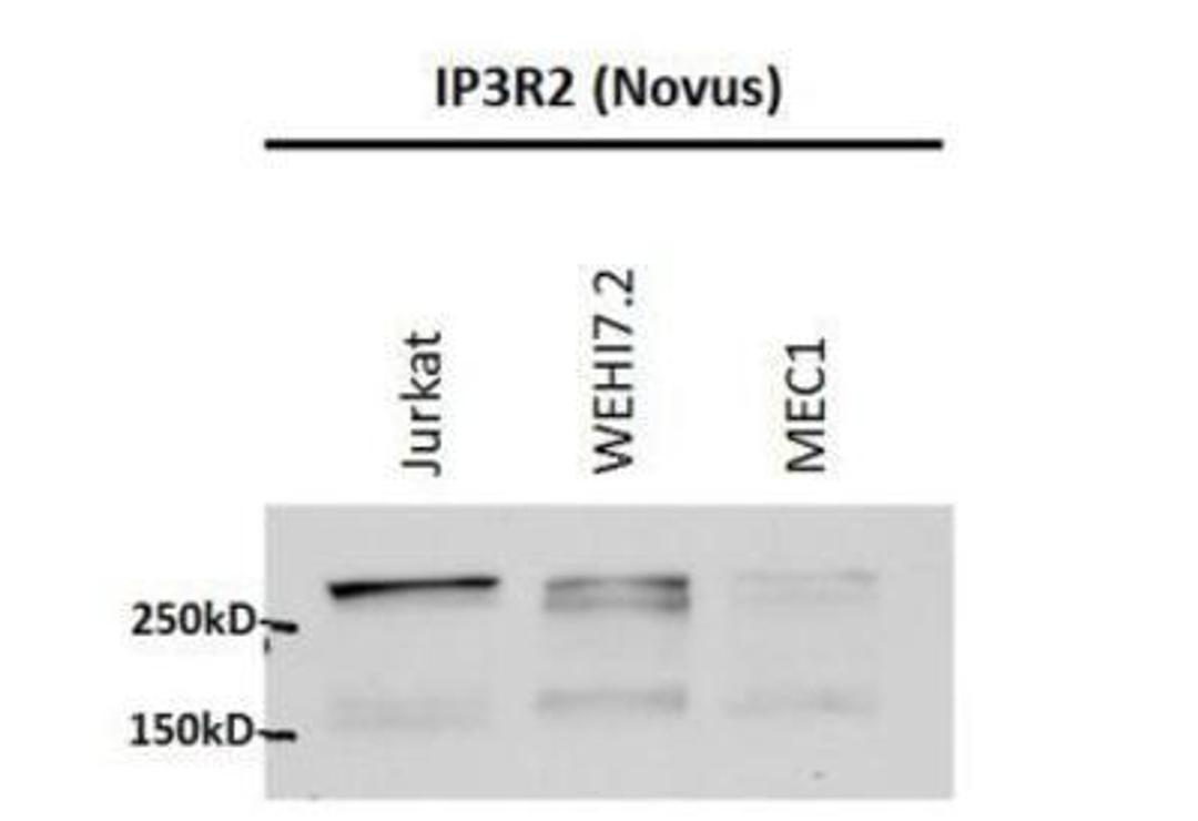 Western Blot: ITPR2 Antibody [NB100-2466] - 2 sec exposure using NB100-2466 on 80 ug total cell lysates listed above.  Primary antibody applied at 1:500 overnight at 4degC, secondary donkey anti-goat applied for 2 hours at room temperature at 1:5000.  (Data provided by Karen McColl at Case Western Reserve University)