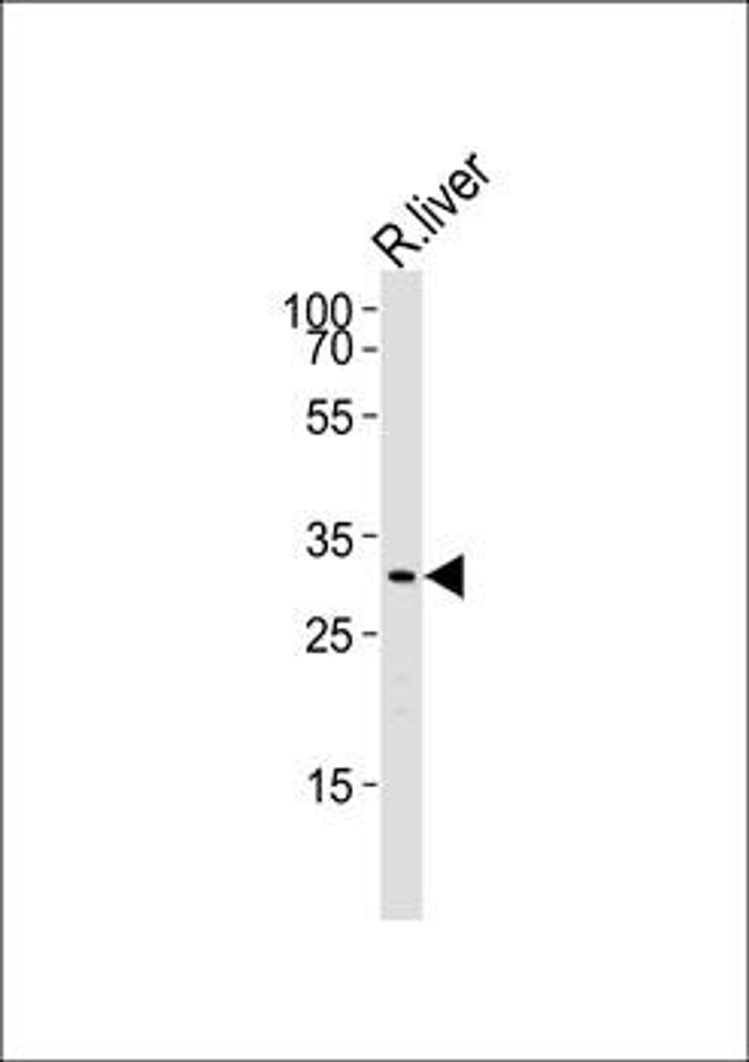 Western blot analysis of Rat liver cell lineusing Cebpb antibody (primary antibody dilution at: 1:1000)