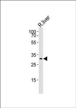 Western blot analysis of Rat liver cell lineusing Cebpb antibody (primary antibody dilution at: 1:1000)