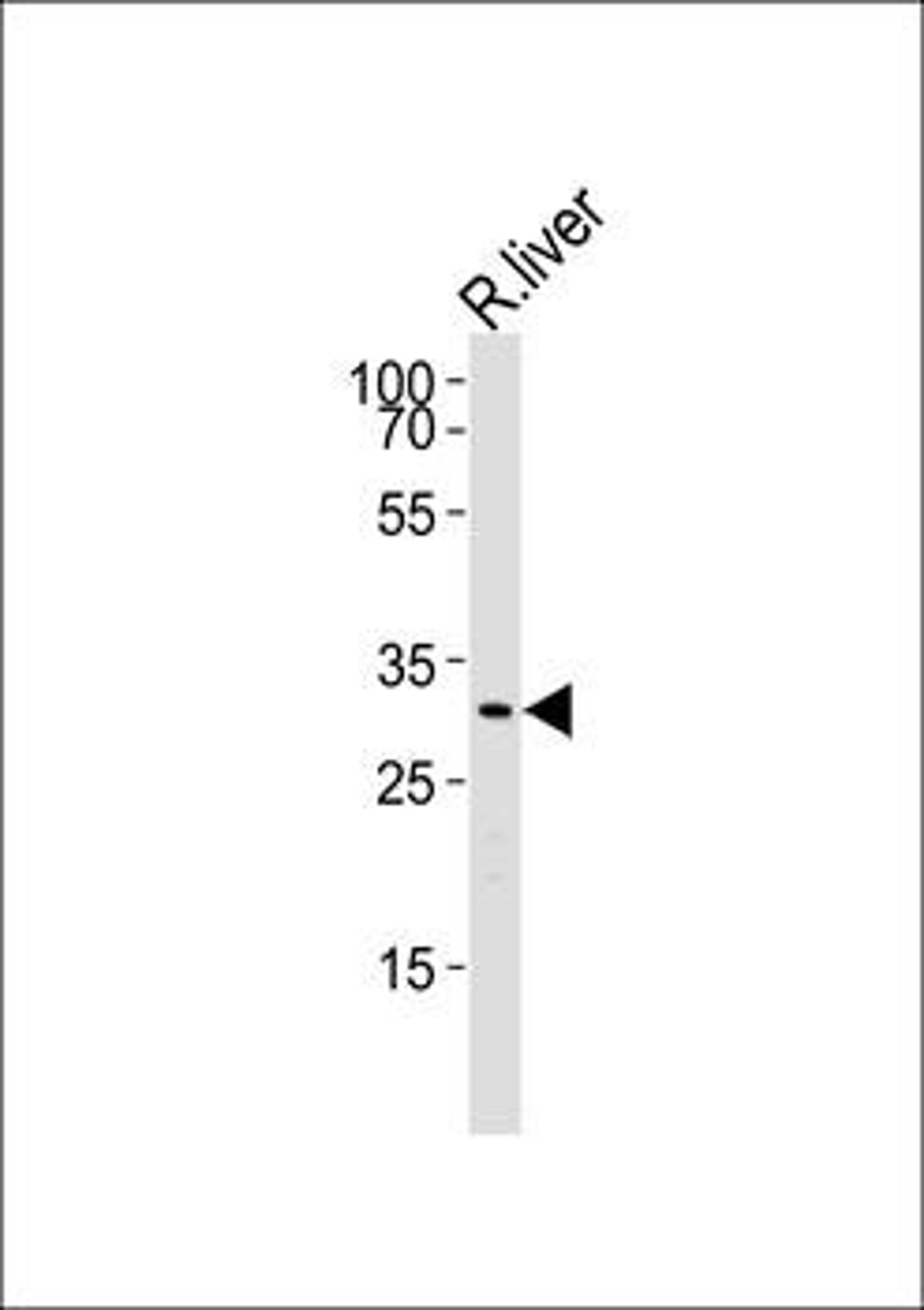 Western blot analysis of Rat liver cell lineusing Cebpb antibody (primary antibody dilution at: 1:1000)