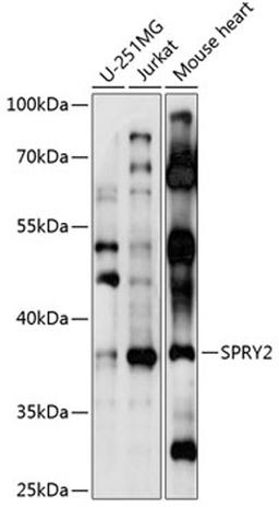 Western blot - SPRY2 antibody (A1855)