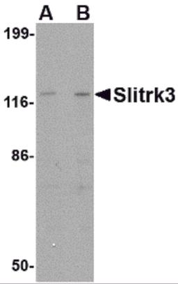 Western blot analysis of Slitrk3 in SK-N-SH cell lysate with Slitrk3 antibody at (A) 0.25 and (B) 0.5 μg/mL.