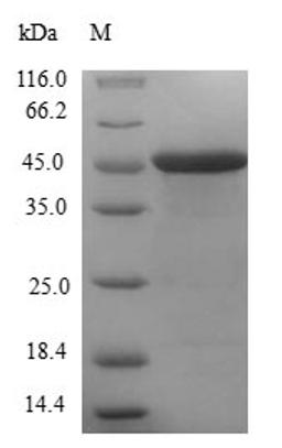 (Tris-Glycine gel) Discontinuous SDS-PAGE (reduced) with 5% enrichment gel and 15% separation gel.