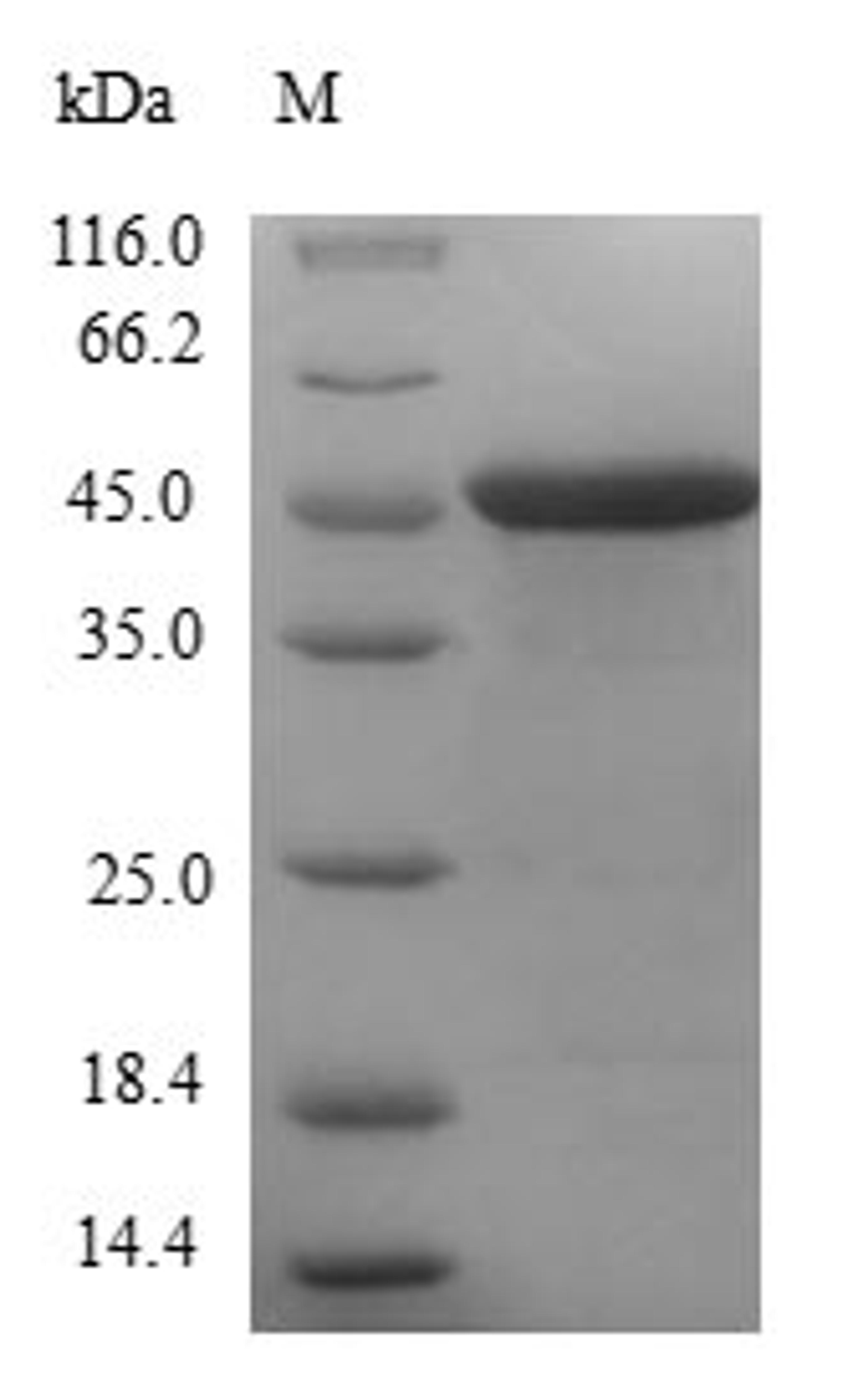 (Tris-Glycine gel) Discontinuous SDS-PAGE (reduced) with 5% enrichment gel and 15% separation gel.