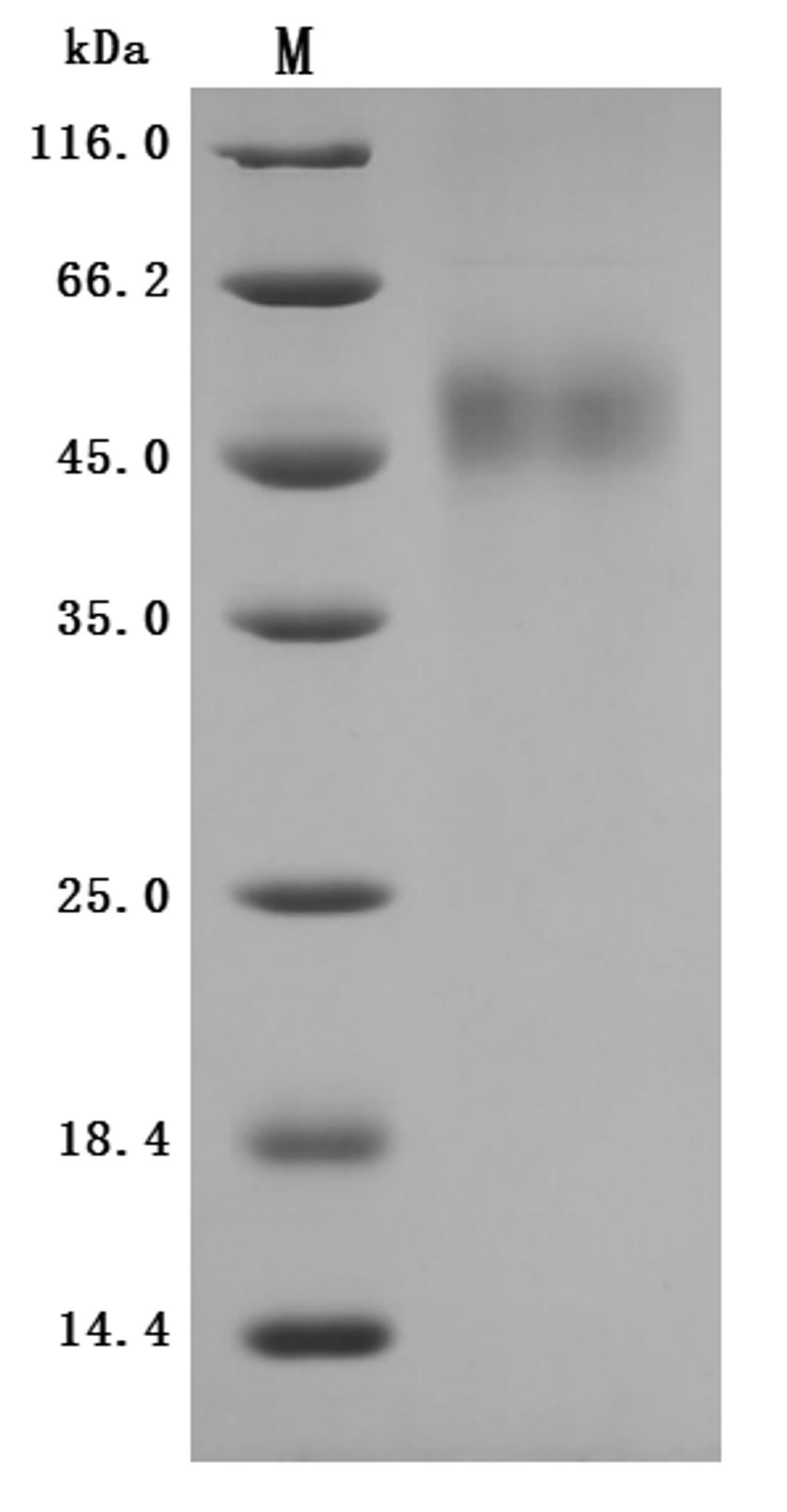 (Tris-Glycine gel) Discontinuous SDS-PAGE (reduced) with 5% enrichment gel and 15% separation gel.