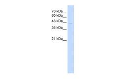 Antibody used in WB on Human Jurkat 0.2-1 ug/ml.