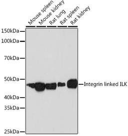 Western blot - Integrin linked ILK Rabbit mAb (A4571)