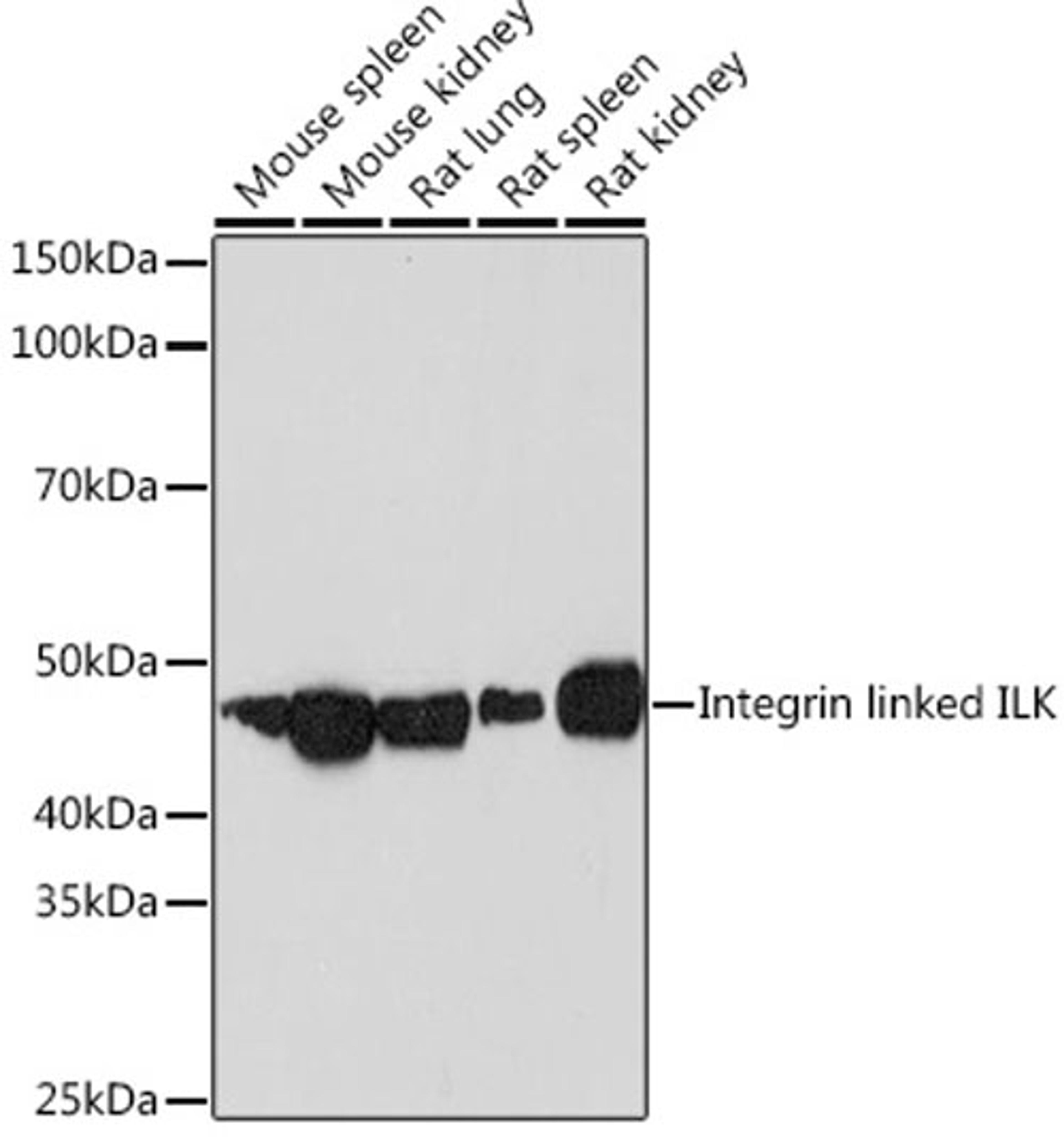 Western blot - Integrin linked ILK Rabbit mAb (A4571)