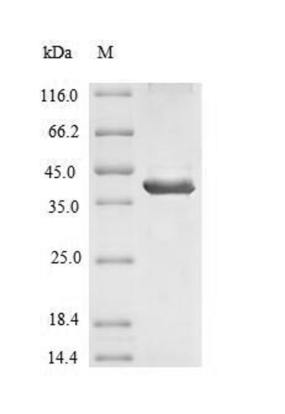 (Tris-Glycine gel) Discontinuous SDS-PAGE (reduced) with 5% enrichment gel and 15% separation gel.