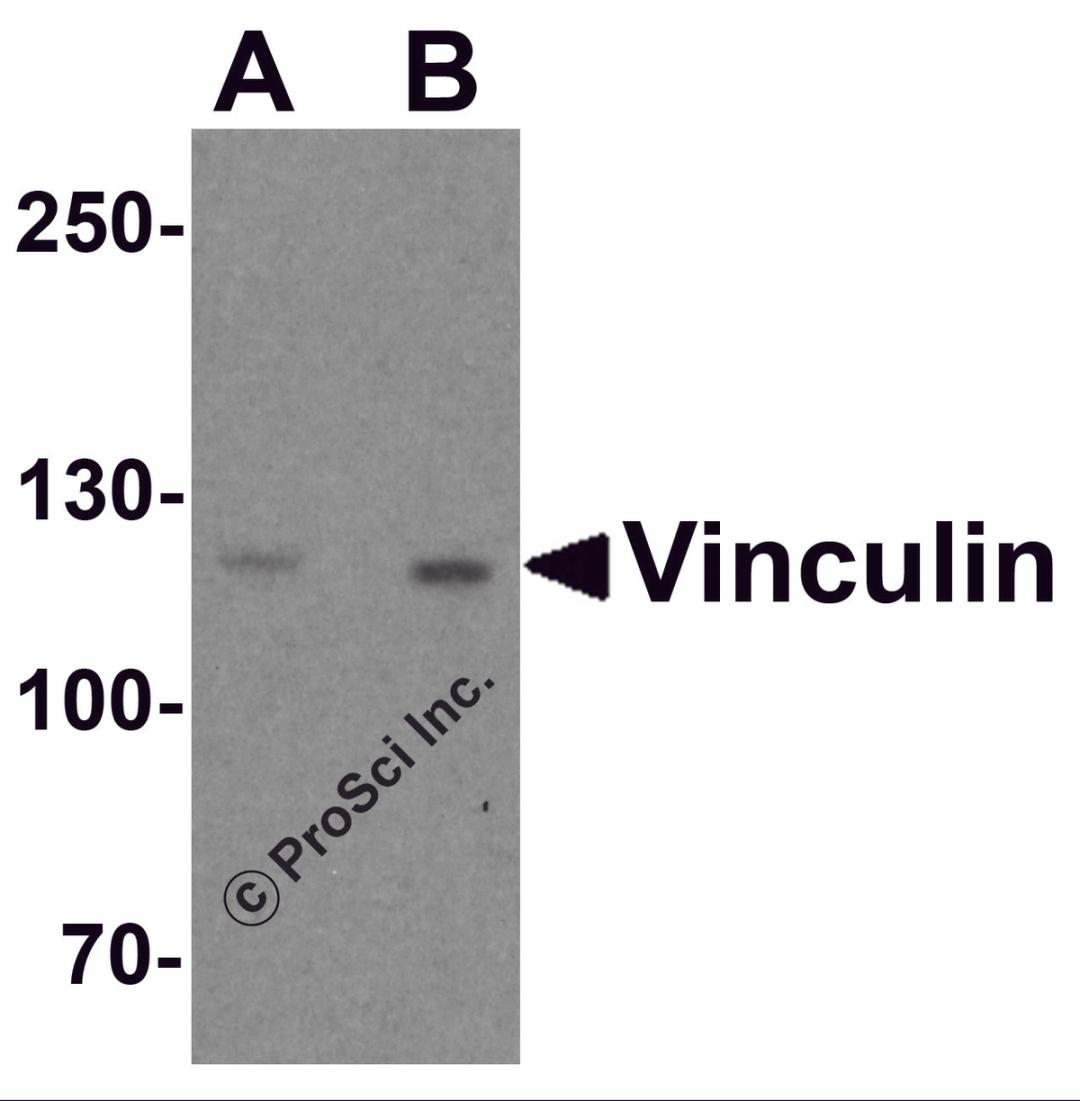 Western blot analysis of Vinculin in PC-3 cell lysate with Vinculin antibody at (A) 1 and (B) 2 μg/ml.
